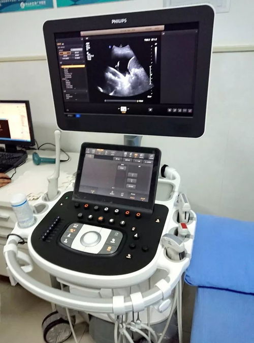 超聲檢查再添利器，來廣華體驗國際高端彩超設備